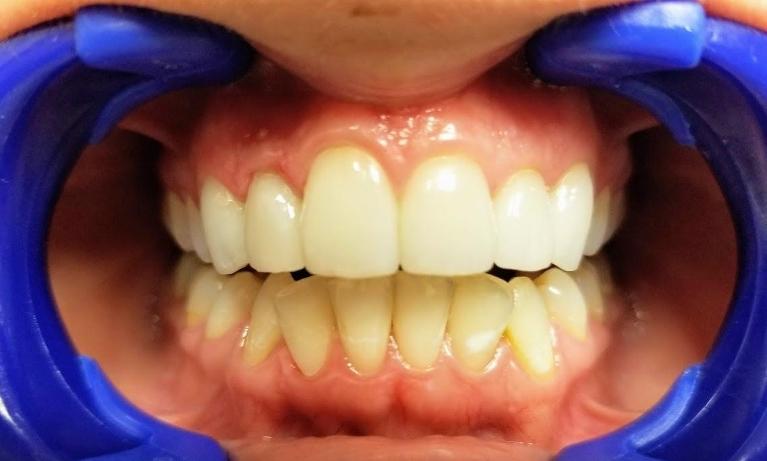 And-She-Can-Not-Stop-Smiling-After-Image