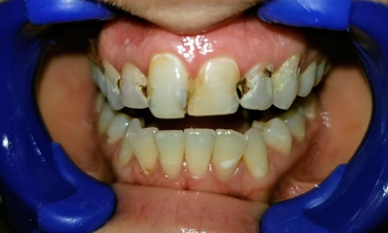 And-She-Can-Not-Stop-Smiling-Before-Image